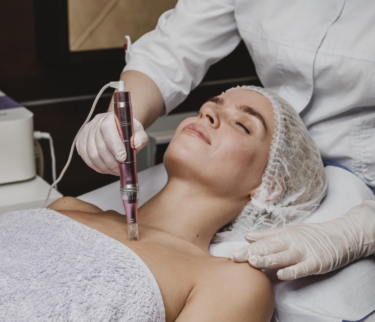 Microneedling with Radio Frequency